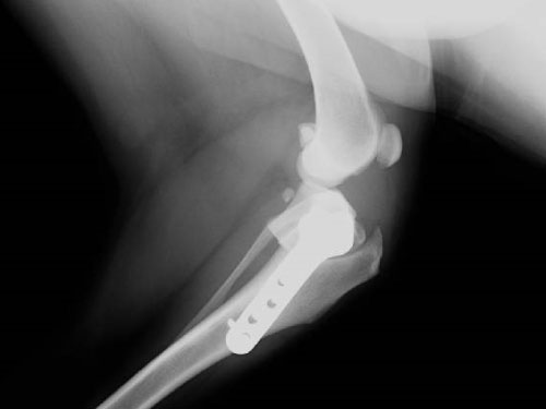 人工靭帯による関節再建術後写真