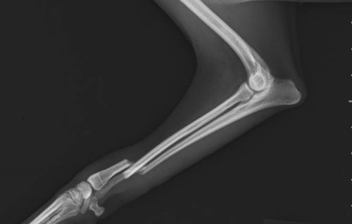 犬の前肢 橈尺骨単純骨折