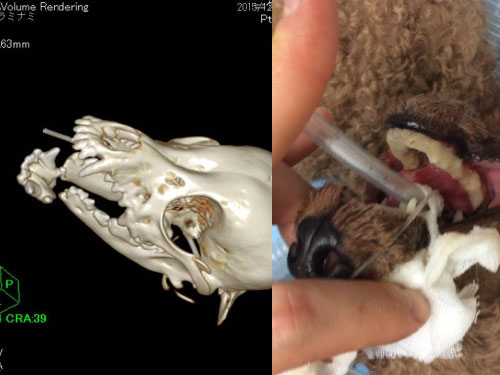 下顎骨折CT写真および歯科用レジfンによる下顎固定 Tプードル